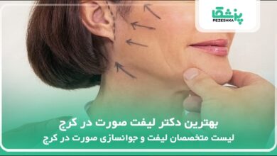 بهترین دکتر لیفت صورت در کرج