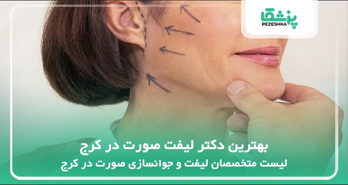 بهترین دکتر لیفت صورت در کرج