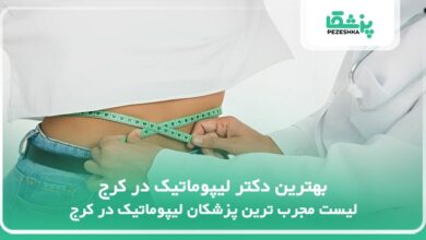 بهترین دکتر لیپوماتیک در کرج