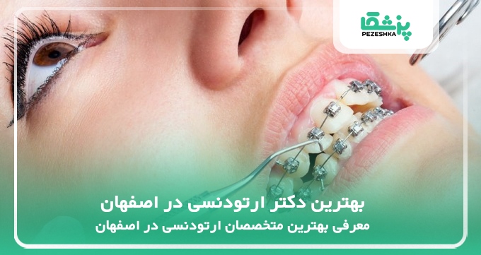 بهترین دکتر ارتودنسی در اصفهان