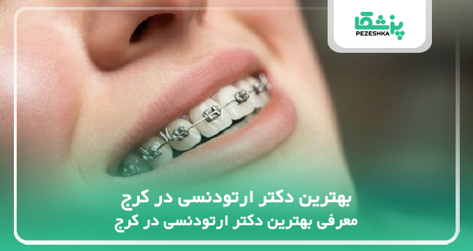 بهترین دکتر ارتودنسی در کرج