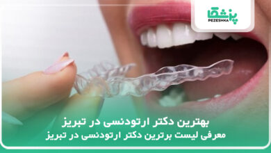 بهترین دکتر ارتودنسی در تبریز