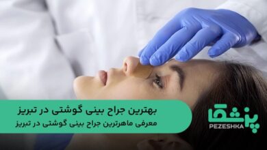 بهترين جراح بينی گوشتی در تبريز