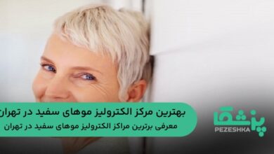 بهترین مرکز الکترولیز موهای سفید در تهران