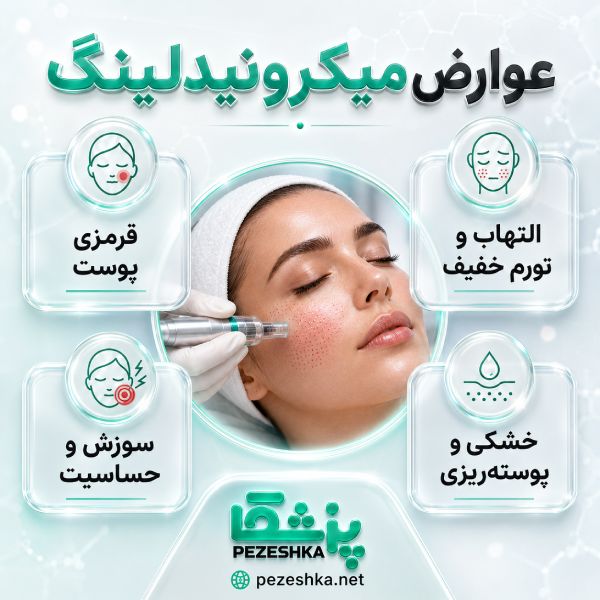 مزایای مزونیدلینگ که باید بدانید :