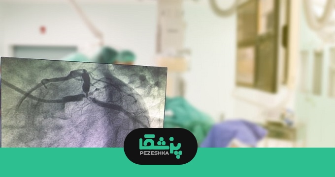 آنژیوگرافی قلب چیست و چگونه انجام می شود؟
