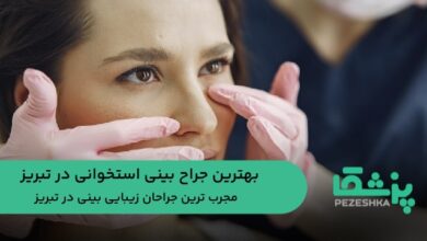 بهترین جراح بینی استخوانی در تبریز