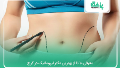 بهترین دکتر لیپوماتیک در کرج