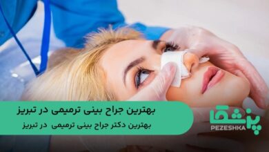 بهترین جراح بینی ترمیمی در تبریز