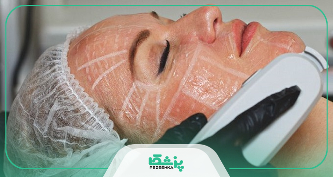 اقدامات بعد از لیزر