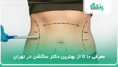 10 تا از بهترین دکتر ساکشن در تهران