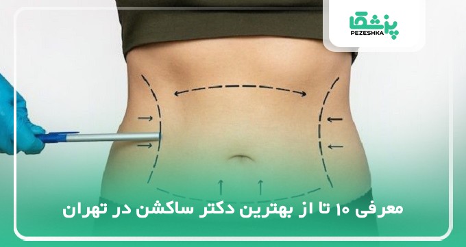 10 تا از بهترین دکتر ساکشن در تهران