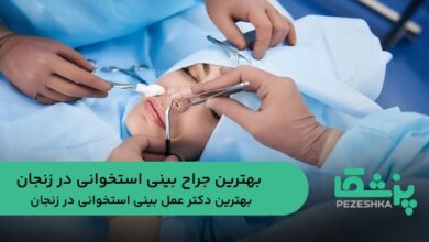 بهترین جراح بینی استخوانی در زنجان
