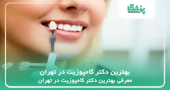 بهترین دکتر کامپوزیت در تهران