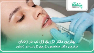 بهترین دکتر تزریق ژل لب در زنجان
