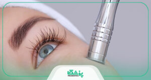 هزینه استفاده از مزونیدلینگ در مشهد چه مقدار می باشد ؟