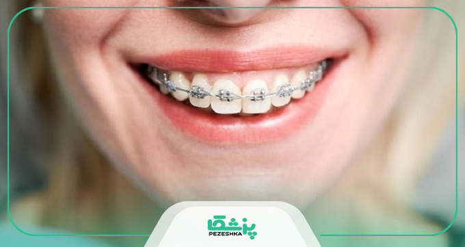 بهترين دكتر ارتودنسي در مشهد بايد چه خصوصياتي داشته باشد؟