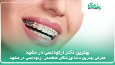 بهترین دکتر ارتودنسی در مشهد
