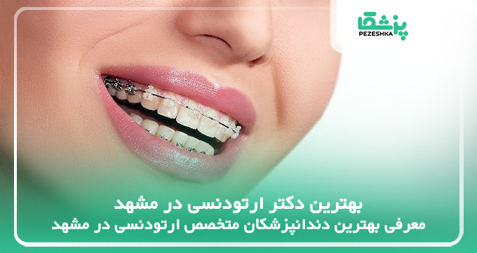 بهترین دکتر ارتودنسی در مشهد