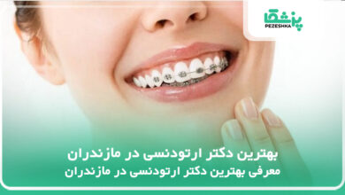 بهترین دکتر ارتودنسی در مازندران