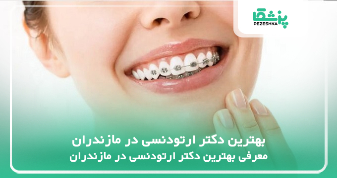 بهترین دکتر ارتودنسی در مازندران