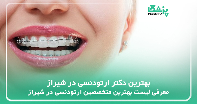 بهترین دکتر ارتودنسی در شیراز