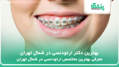بهترین دکتر ارتودنسی در شمال تهران