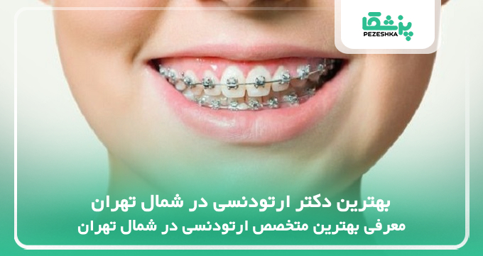 بهترین دکتر ارتودنسی در شمال تهران