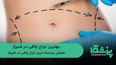 جراح چاقی در شیراز