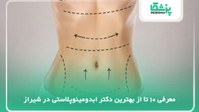 بهترین دکتر ابدومینوپلاستی در شیراز