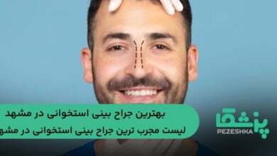 10 تا از بهترین جراح بینی استخوانی در مشهد