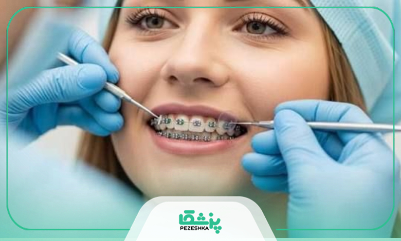 مراحل انجام ارتودنسی