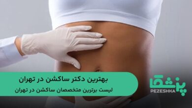 بهترین دکتر ساکشن در تهران