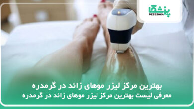 بهترین مرکز لیزر موهای زائد در گرمدره