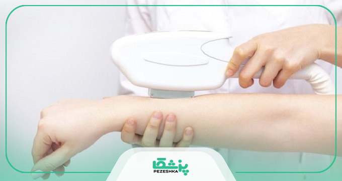 مزایا و معایب لیزر موهای زائد بدن