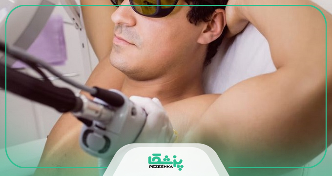 چه افرادی نباید لیزر موهای زائد انجام دهند؟