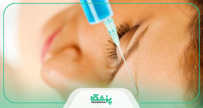 نکات مثبت و منفی تزریق بوتاکس