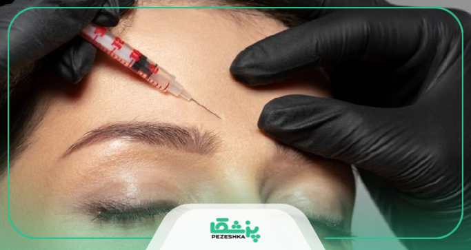 اصلی ترین کاربرد های تزریق بوتاکس