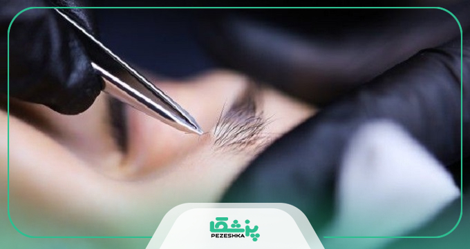 چه دلایلی سبب کم پشتی ابرو می شوند؟