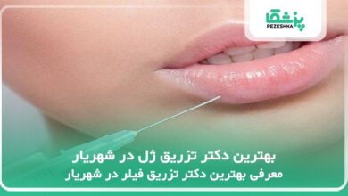 بهترین دکتر تزریق ژل در شهریار