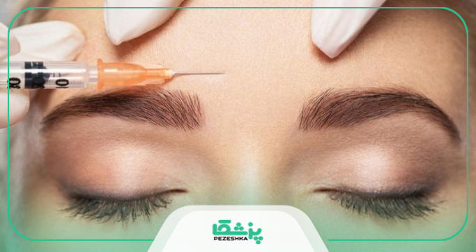 توصیه های لازم جهت تزریق بوتاکس