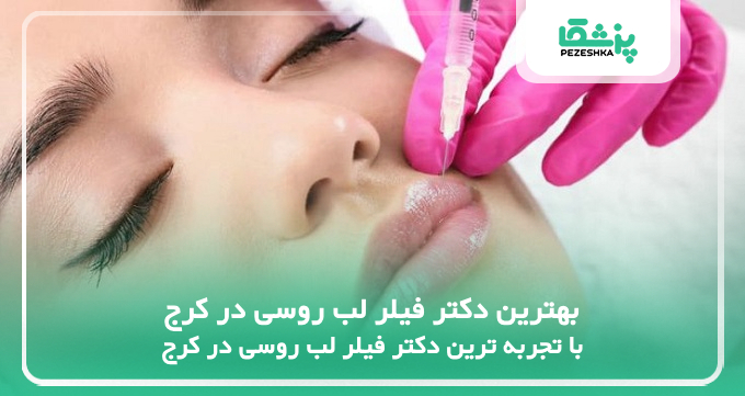 بهترین دکتر فیلر لب روسی در کرج