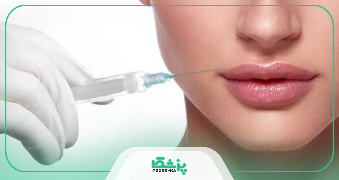 مدل های مختلف تزریق فیلر لب طبیعی با سایربرند ها