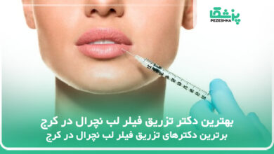 بهترین دکتر تزریق فیلر لب نچرال در کرج