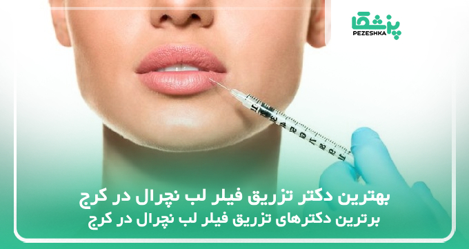 بهترین دکتر تزریق فیلر لب نچرال در کرج