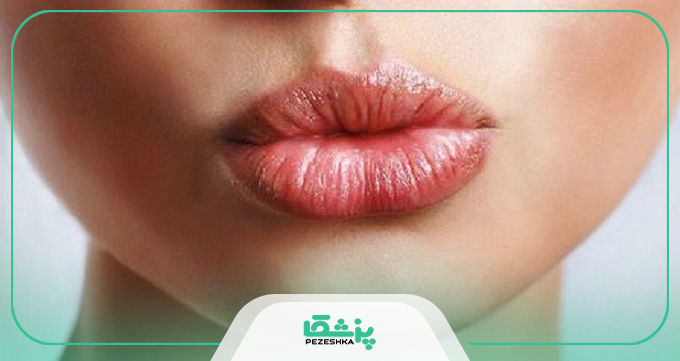 بهترین دکتر تزریق ژل لب طبیعی در کرج چه خدماتی ارائه می دهد؟