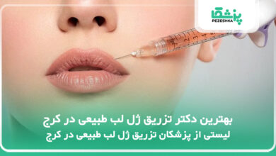 بهترین دکتر تزریق ژل لب طبیعی در کرج