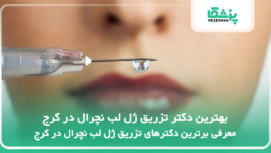 بهترین دکتر تزریق ژل لب نچرال در کرج