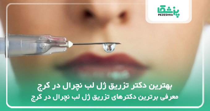 بهترین دکتر تزریق ژل لب نچرال در کرج
