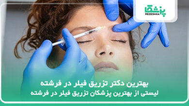 بهترین دکتر تزریق فیلر در فرشته